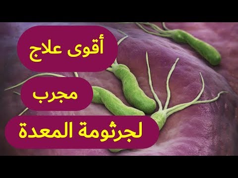 علاج مجرب لجرثومة المعدة - افضل دواء لتعب البطن 694