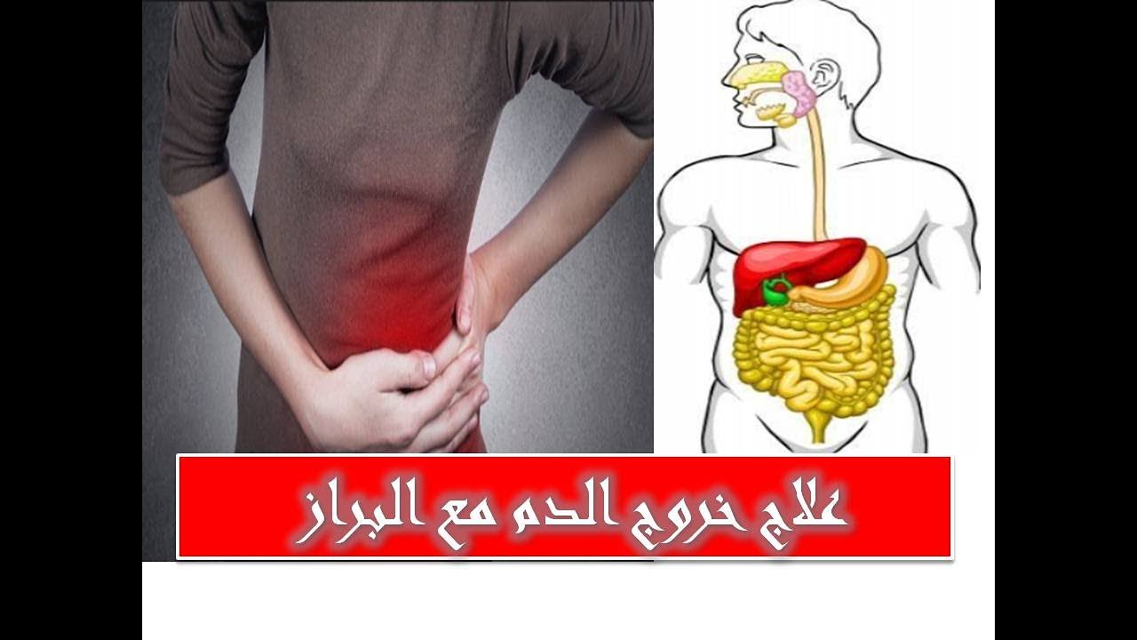 خروج دم مع البراز - اسباب تعب المعدة 595