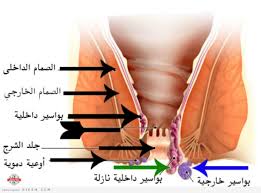 اللي تعاني من بواسير امساك شرخ تتفضل عن تجربه شخصيه وفوائد عديده Unnamed File 556