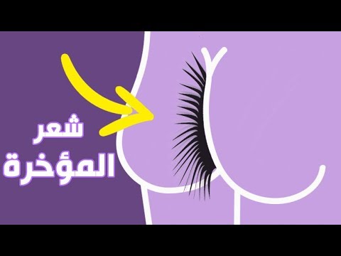 شعر المؤخرة , طرق ازالة الشعر